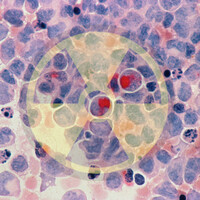 Leucemia infantile e centrali nucleari